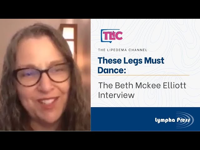 These Legs Must Dance: The Beth McKee Elliott Interview