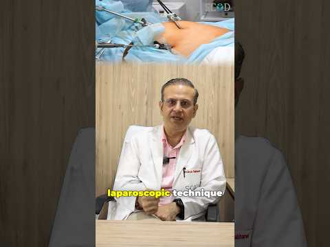 How Bariatric Surgery is done