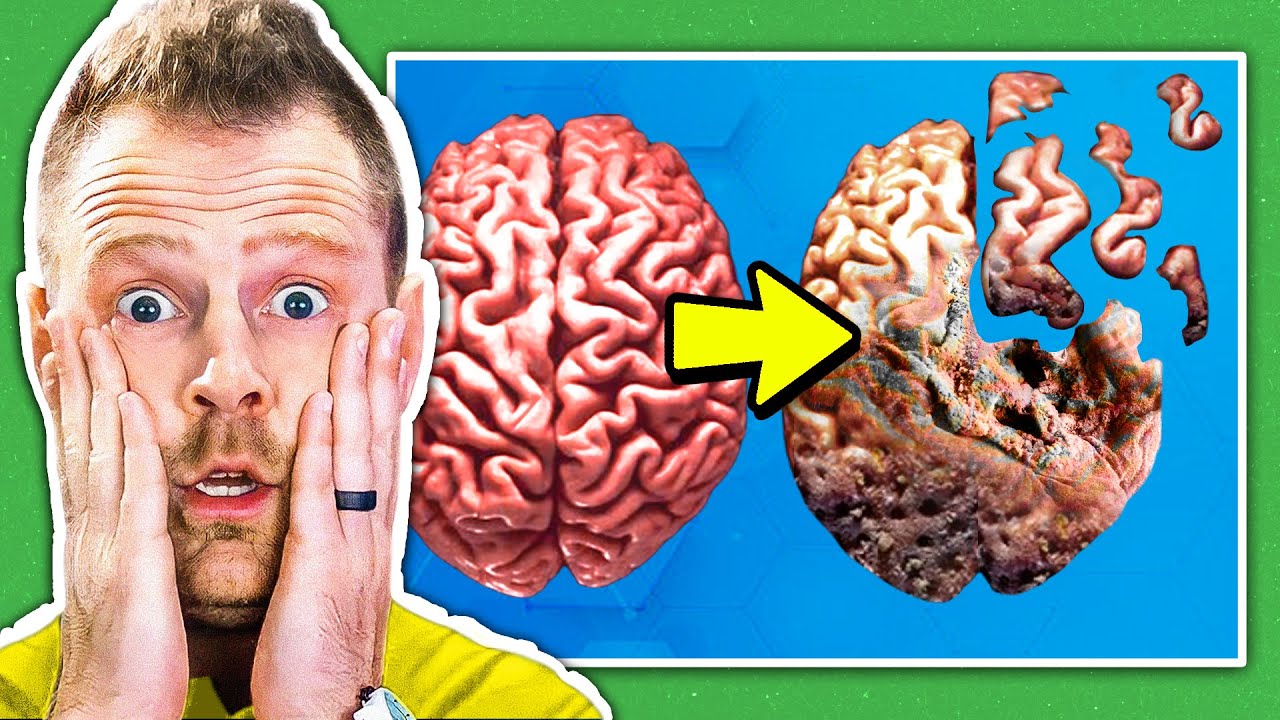 Here’s What Makes You Lose Brain Health