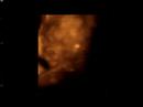 Baby's 4D Ultrasound