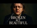 Broken But Beautiful Lewis Capaldi Official Emotional Ballad EternaFM