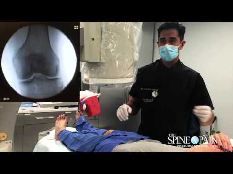 Operatii cu succes - tumori osoase | Centrul Medical Anadolu - Tratamentul osteomului la genunchi
