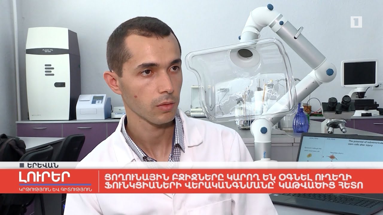 Ցողունային բջիջները կարող են օգնել ուղեղի ֆունկցիաների վերականգնմանը կաթվածից հետո