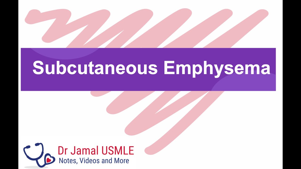 Subcutaneous Emphysema! Can you feel the bubbles? by Dr Jamal USMLE - YouTube