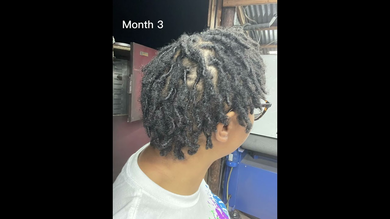 Loc journey Month 1-5| Starter Locs