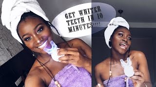 HOW I WHITEN MY TEETH AT HOME IN 10 MINUTES || HISMILETEETH