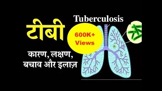 Tuberculosis causes, symptoms, treatment &amp; prevention in Hindi | टीबी के कारण, लक्षण, बचाव और इलाज़