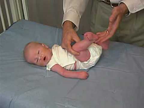 neurology exam: newborn-abnormal: Tone - Popliteal Angle