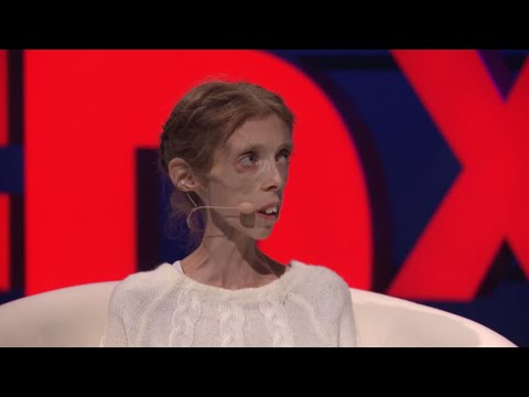 Nostalgia | Lene Marie Fossen & Morten Krogvold | TEDxArendal