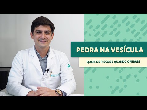 Pedra na Vesícula: causas, sintomas e tratamento // Viver Bem