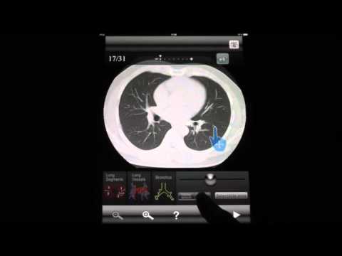 Chest CT Sectional Walker Video