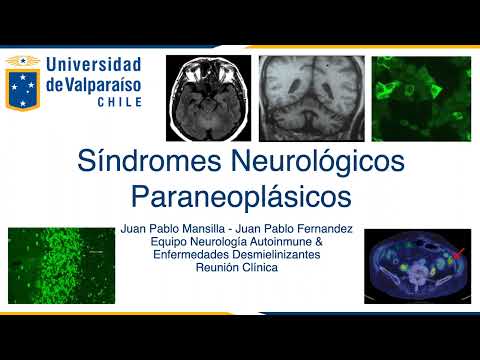 Juan Pablo Mansilla Figueroa-15
