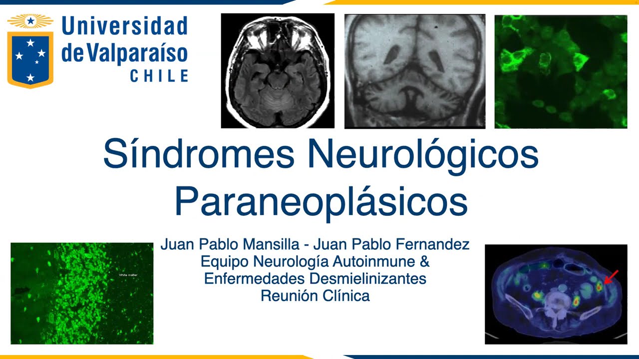 Juan Pablo Mansilla Figueroa-15