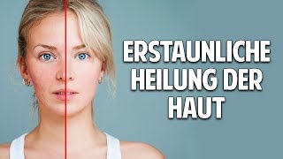 Probleme mit der Haut? Erstaunliche Heilung durch natürliche Kosmetik