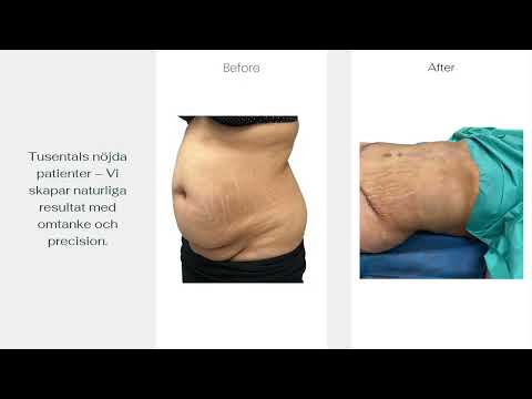 Doctor Bunda - Plastikkirurgi i Stockholm - Med Fokus på Naturliga resultat