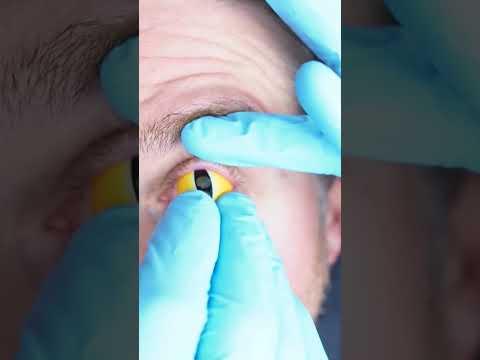 How To Put In Huge Sclera Halloween Contacts