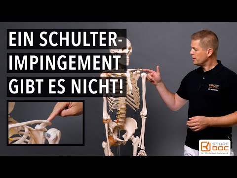 Das Impingementsyndrom der Schulter gibt es eigentlich nicht!