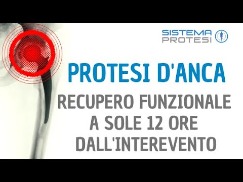 Stoppini più iniezioni per lacquisto congiunto CMT per il mal di schiena