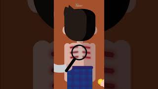 Download lagu How Does Scraping Heal the Body? mp3 Download lagu How Does Scraping Heal the Body? mp3