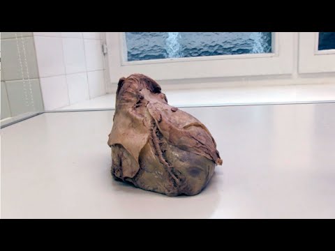 2 Fragen 1 Organ - Herz