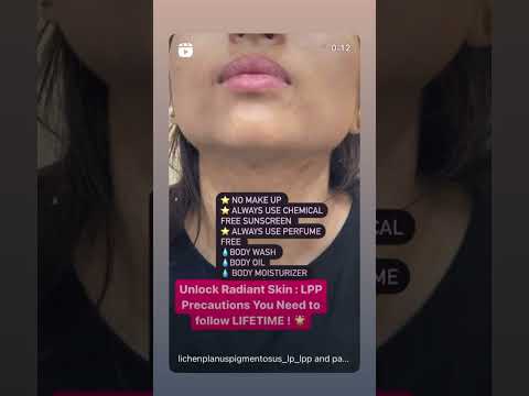 Precautions for LPP | Lichen Planus Pigmentosus| Dr Ashima Goel | Dermatologist in Punjab |Parisa