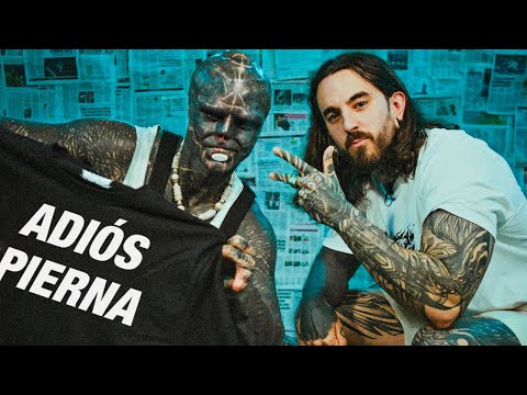 THE BLACK ALIEN INTERVIEW: «Yes, I will get my LEG done» 🤯
