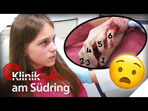 "Freak": Mädchen mit 6. Finger wird in Schule gemobbt - jetzt soll er ab 👆🏻 |Klinik am Südring|SAT.1