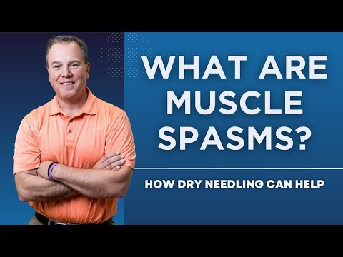 What Are Muscle Spasms? How Dry Needling Can Help