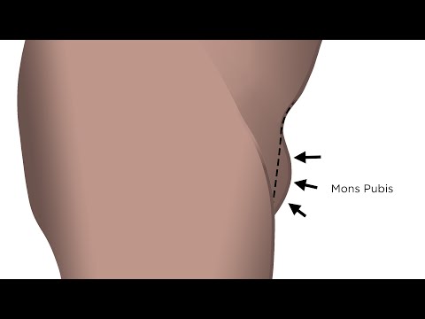 Mons pubis zsírvesztés