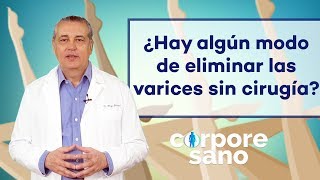 ¿Cómo eliminar varices sin cirujía | Corpore Sano