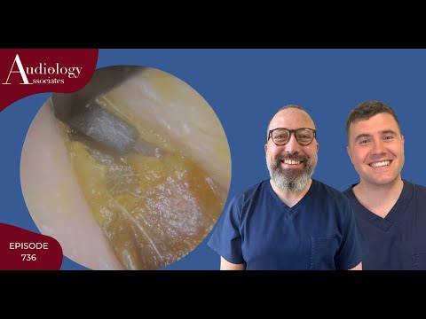 HARD SKIN & EAR WAX PLUG REMOVAL - EP736