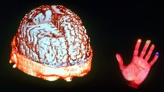 Advanced Brain Science: Optogenetics and Expansion Microscopy | Ed Boyden