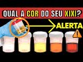 WHAT YOUR URINE COLOR SAYS ABOUT YOUR BODY S HEALTH WARNING SIGNS THAT SOMETHING IS NOT GOING WELL