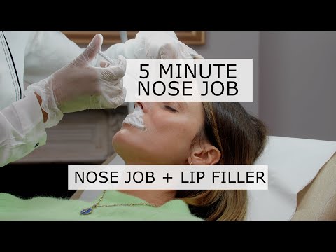 Kate’s Non-Surgical Nose Job + Lip Enhancement Treatment