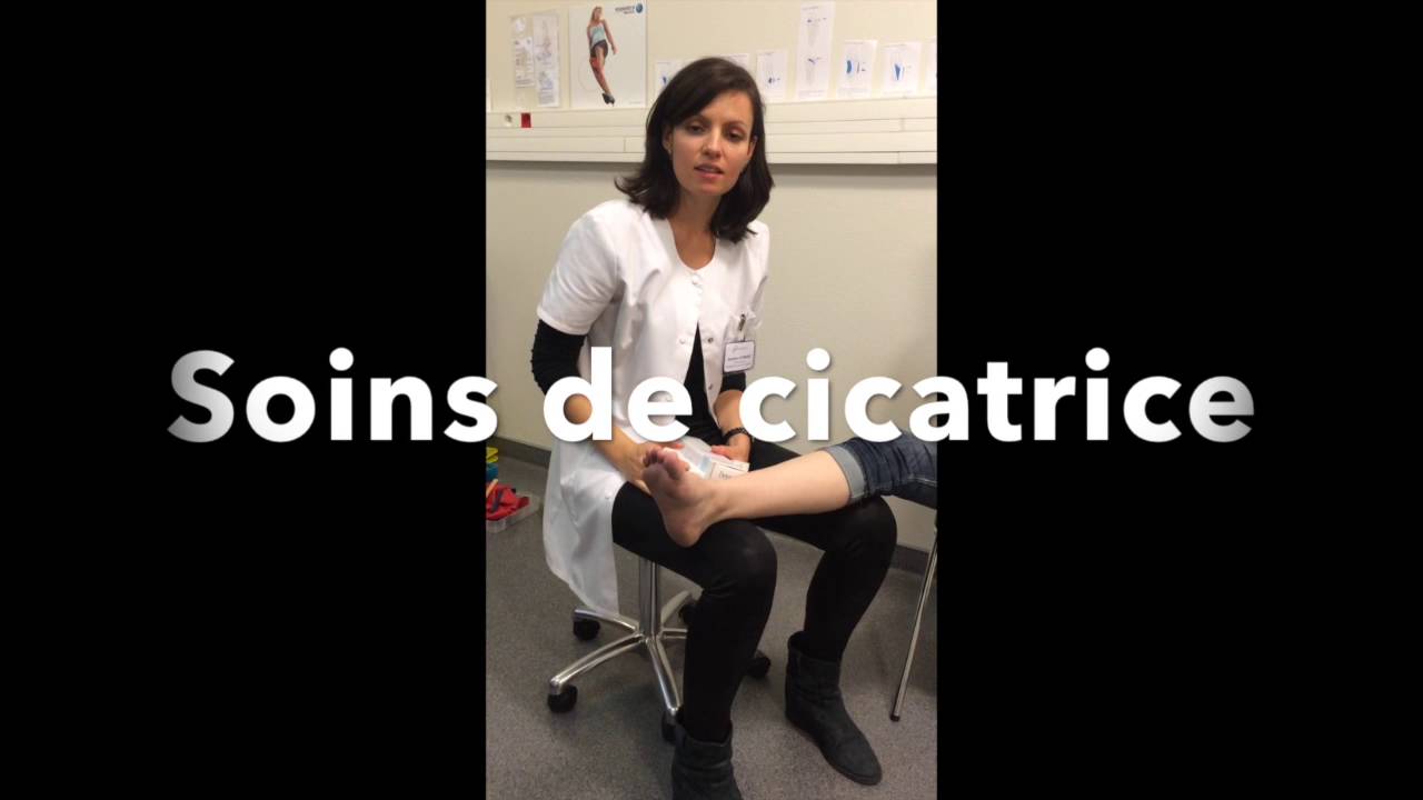 Consignes post ope?ratoires