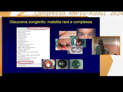 Congresso  - Il Bambino Glaucomatoso dalla Nascita