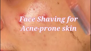 Face shaving for acne prone skin | Prisha Mudgal #shorts #faceshaving #acneproneskin