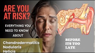 Chondrodermatitis Nodularis Helicis Explained Causes, Symptoms and Treatment, All Insights