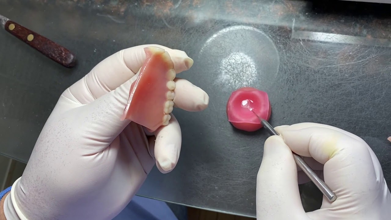 Trick to Gluing a Broken Denture