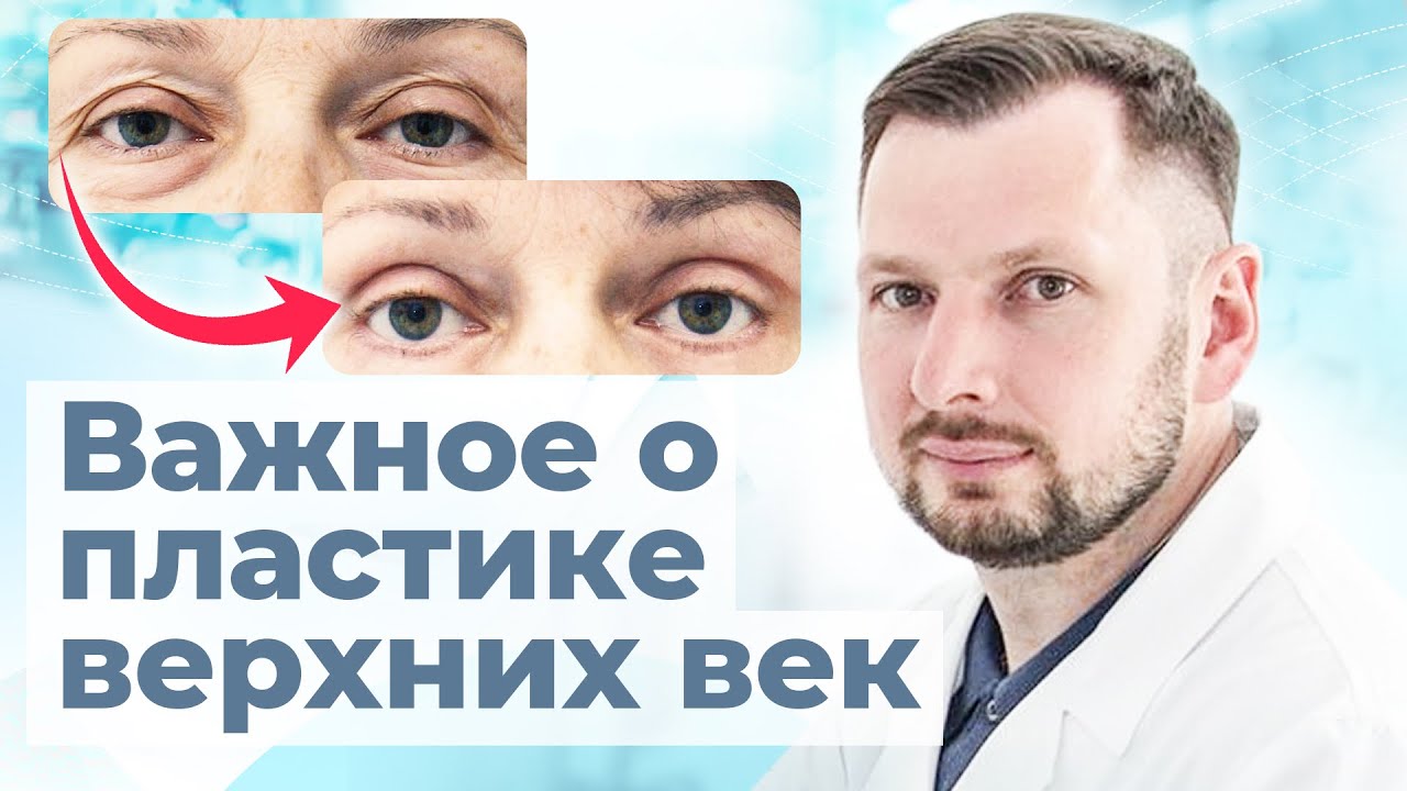 Блефаропластика верхних век. Бесшовная операция, верхняя ...