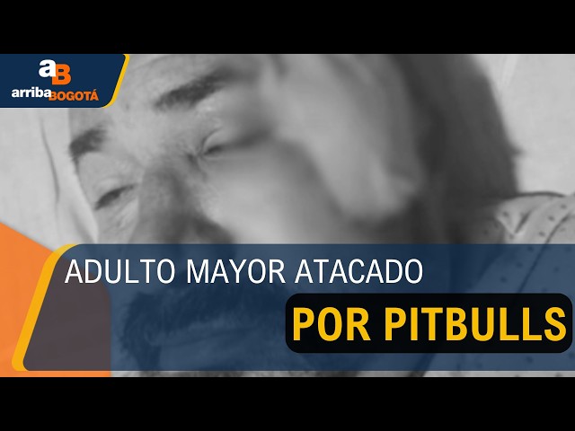 Un adulto mayor de 66 años fue atacado por dos perros pitbull en el sur de Bogotá