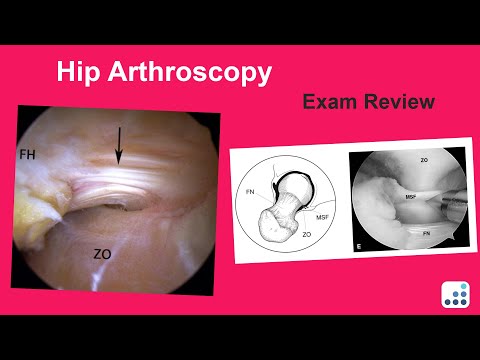 Hip Arthroscopy Exam Review - John Clohisy, MD