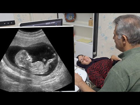 🫄The Little Beat of Love: When Fatima Went to the Doctor to Hear Her Fetal Heartbeat