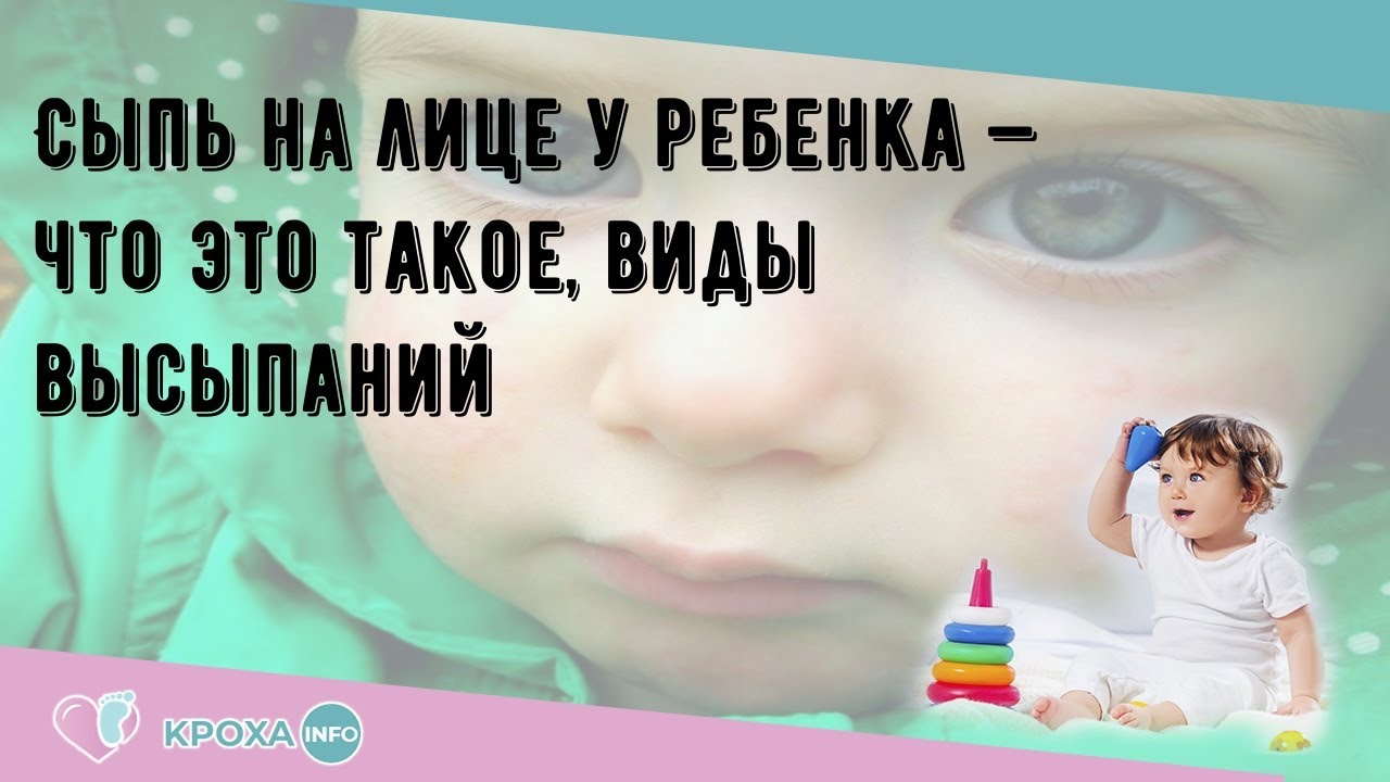 Сыпь на лице у ребенка — что это такое, виды высыпаний