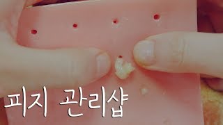 피지 관리샵 상황극 ｜ASMR｜Squeezing Sebum roleplay