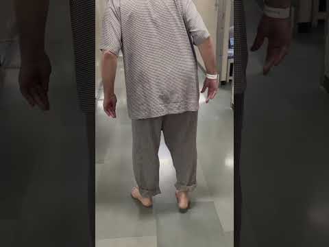 What is Lumbar canal stenosis : how does it lead to foot drop