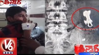 Chain Snatcher Swallows Gold Chain | Secunderabad | Teenmaar News | V6News