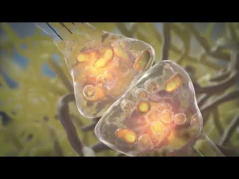 Mechanism of Alzheimer's Disease