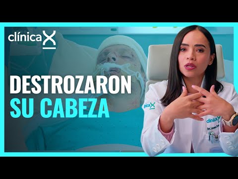 Sus asaltantes lo dejaron al borde de la muerte | Temporada 2 | Clínica X