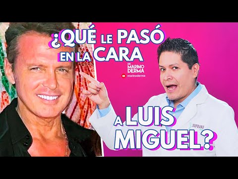 QUE LE PASO EN LA CARA A LUIS MIGUEL